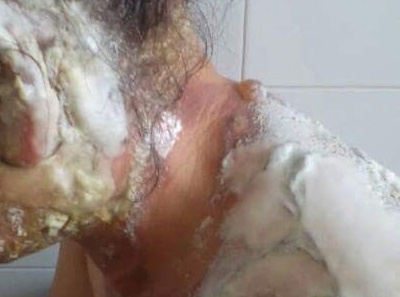 Chong do ca binh nuoc soi vao tai vo hinh anh