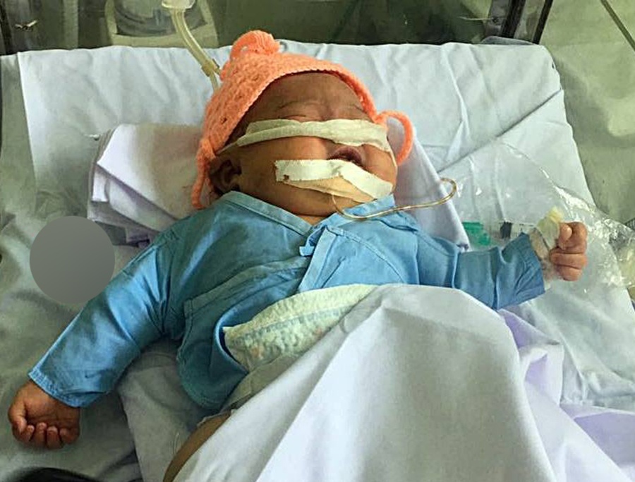 Be gai so sinh bi gay tay khi vua chao doi hinh anh