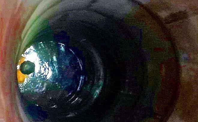 Cuu nguoi dan ong 44 tuoi bi ngat khi duoi gieng hinh anh