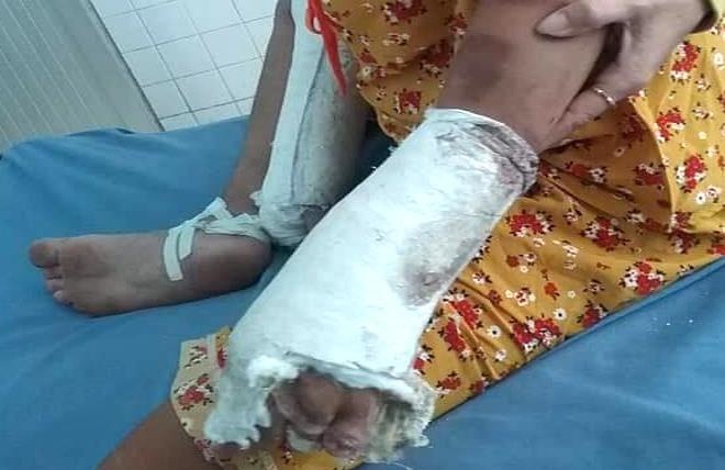 Ba bau bi chong ho danh gay tay, chan hinh anh