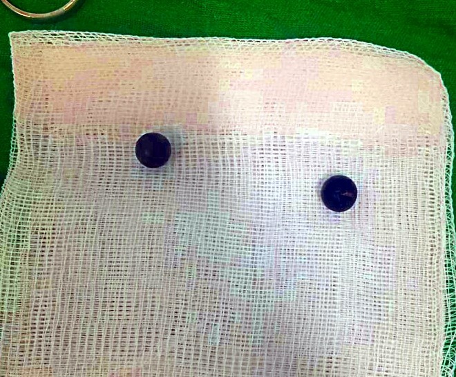 giam dinh thuong tat chu no bi ban anh 1