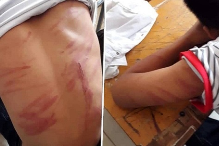 Nam thanh nien bi nhot, danh suot dem vi nghi trom ga hinh anh