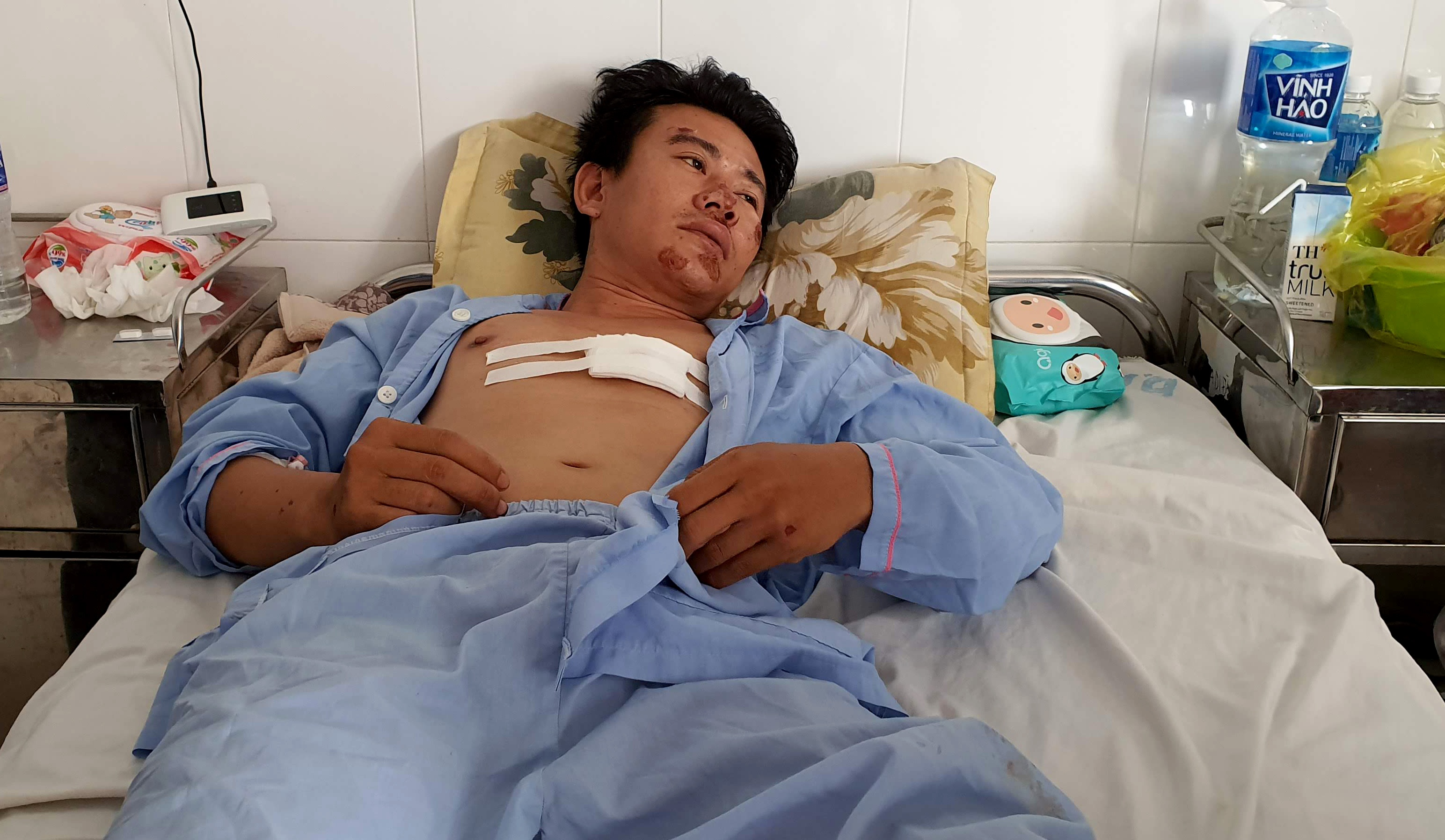 cong an xa ban thanh nien gay roi trong tram y te anh 1