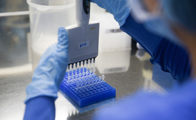 Nhan vien quan ca phe Highlands am tinh lan 1 voi SARS-CoV-2 hinh anh