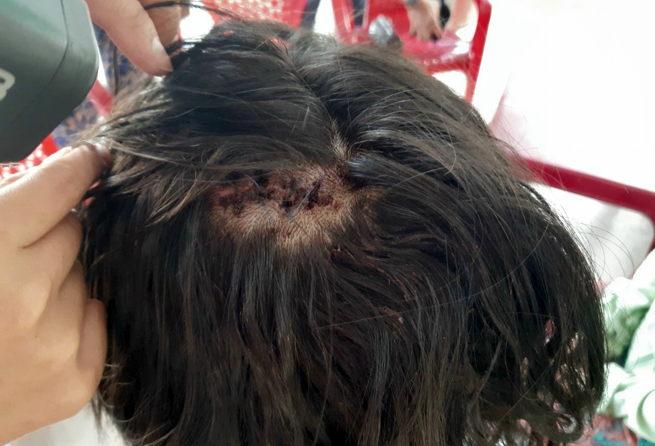 Nu sinh bi danh hoang so ke lai vu viec anh 2