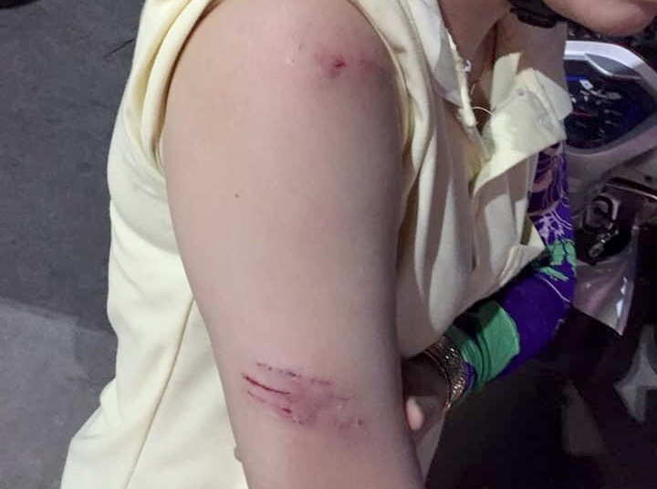 dan khi tan cong hoc sinh cuop thuc an anh 1