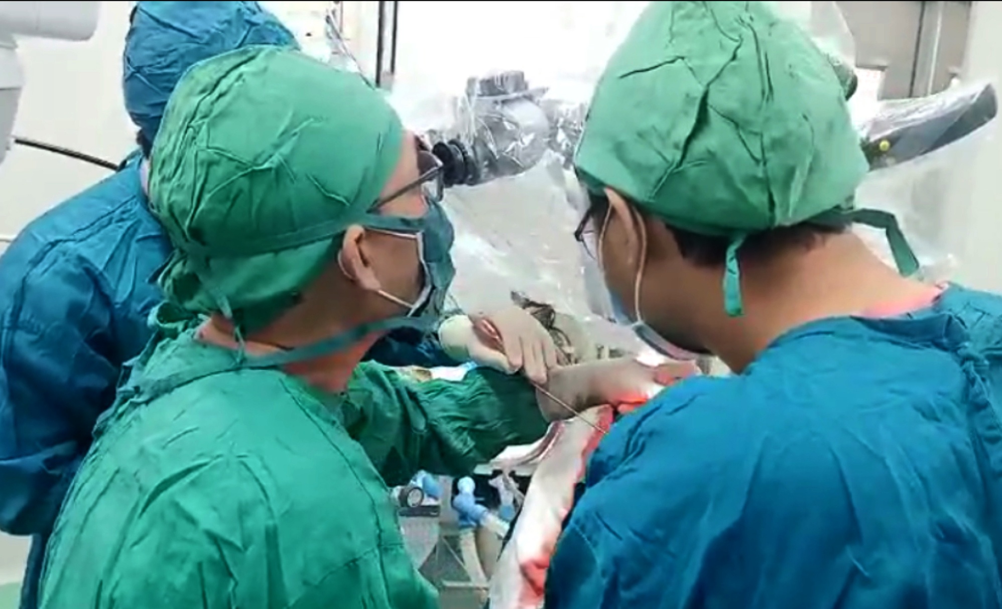 Benh vien tinh lan dau phau thuat thanh cong ca u mang nao hinh anh