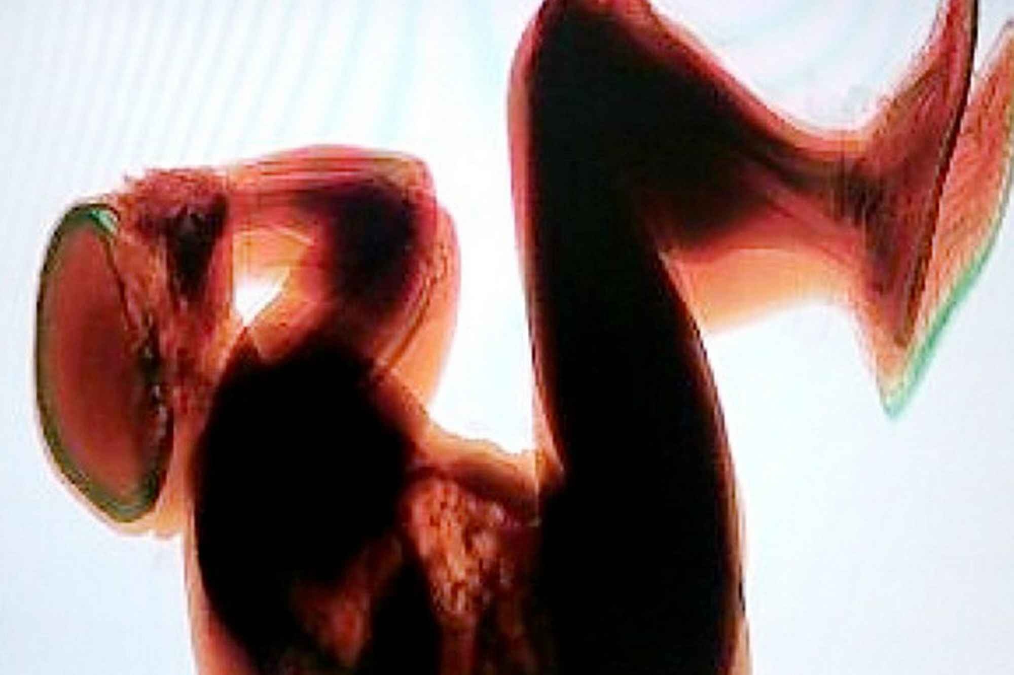 Hành khách Nauy say rượu ngủ trên băng chuyền hành lí: Một du khách người Nauy xuất hiện ở sân bay Fiumicino tại Rome cho chuyến bay về Oslo trong tình trạng say khướt. Sau khi làm thủ tục lên máy bay, vị khách 36 tuổi đã lăn ra ngủ trên băng chuyền hành lí cho tới khi qua máy quét. Tất nhiên nhân viên sân bay đã phát hiện ra và báo cảnh sát.