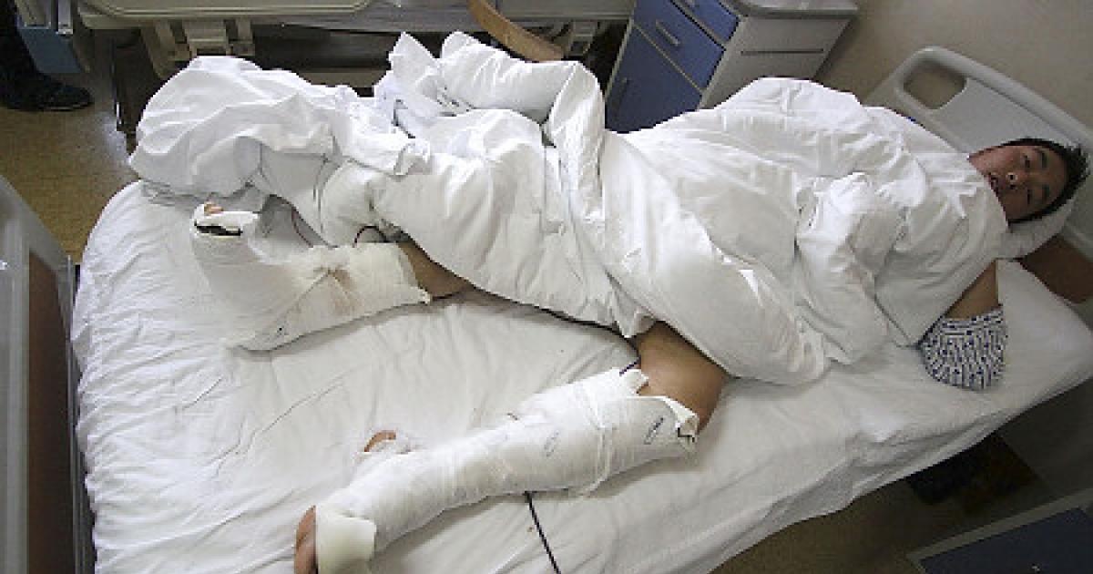 Chú gấu trúc khổng lồ Gu Gu ( năm 2006/2007/2009): Tất nhiên không thể phủ nhận gấu trúc là loài vô cùng dễ thương, nhưng ba du khách tới sở thú Bắc Kinh đã phát hiện ra chúng còn có móng vuốt sắc nhọn.  Du khách đầu tiên là một người đàn ông 35 tuổi tên Zhang Xinyan, anh đã nhảy vào khu chuồng nuôi gấu trúc trong tình trạng say khướt và ôm chú gấu Gu Gu nặng hơn 100kg. Xinyan đã bị Gu Gu cắn vào chân. Du khách thứ hai là một cậu bé 15 tuổi tên Li Xitao, cậu đã tiến sát Gu Gu lúc nó đang ăn. Chân Xitao đã bị con gấu trúc cắn rách tới mức lòi cả xương ra. Năm 2009, một du khách tên Zhang đã nhảy vào chuồng gấu trúc để nhặt món đồ chơi con làm rơi. Gu Gu lại tấn công du khách đó vào chân, nó có vẻ tức giận đến mức các nhân viên sở thú phải dùng công cụ để nạy hàm nó ra.