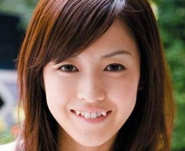 Răng khểnh giả: Phụ nữ Nhật rất thích có răng khểnh, nhiều người còn tiêu tốn hàng trăm đôla để gắn răng khểnh giả.