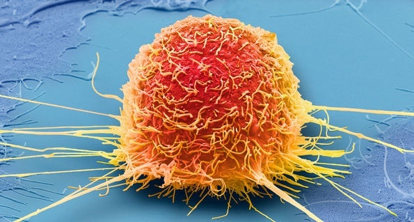 Cach lam doi te bao ung thu khong lam suy kiet benh nhan hinh anh
