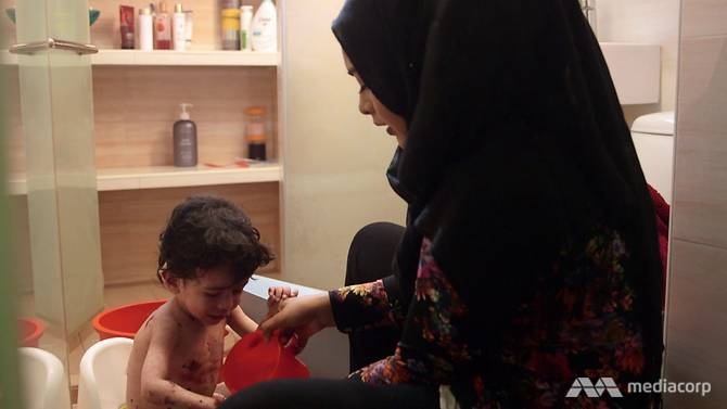 Cuộc sống đầy đau đớn của những đứa trẻ ‘bươm bướm’ ảnh 2 Cuoc song day dau don cua nhung dua tre ‘buom buom’ anh 2