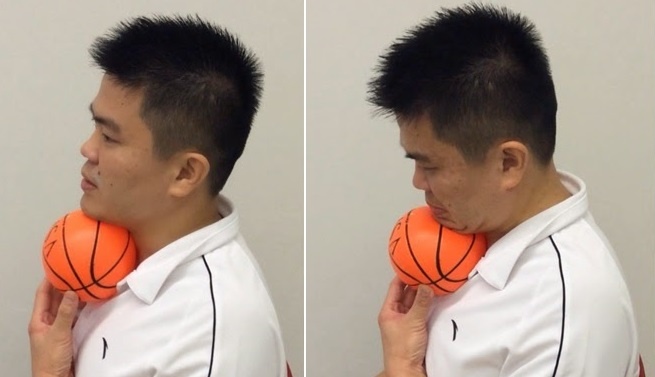 3 cach giam bong mo cam khong can phau thuat anh 4