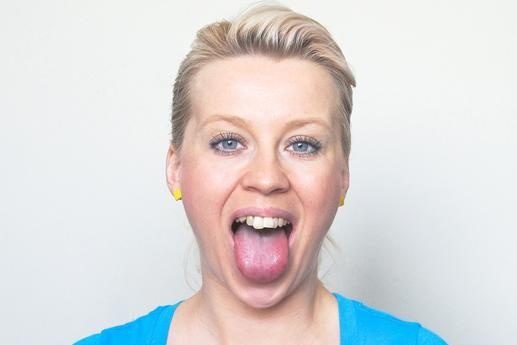 3 cach giam bong mo cam khong can phau thuat anh 5