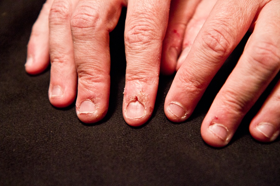 Hiem hoa bat ngo tu thoi quen can mong tay anh 4