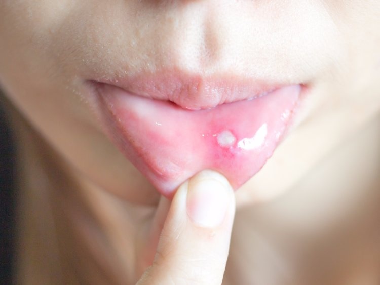 9 dau hieu cho thay ban dang thieu vitamin hinh anh