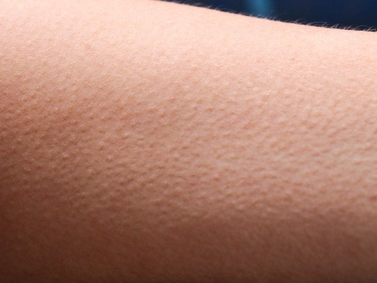 10 dau hieu cho thay ban dang thieu vitamin anh 5