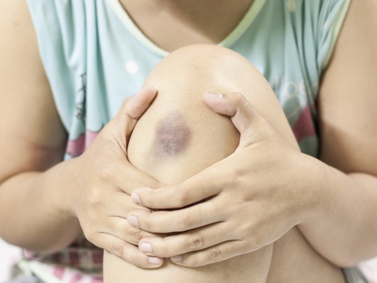 10 dau hieu cho thay ban dang thieu vitamin anh 7