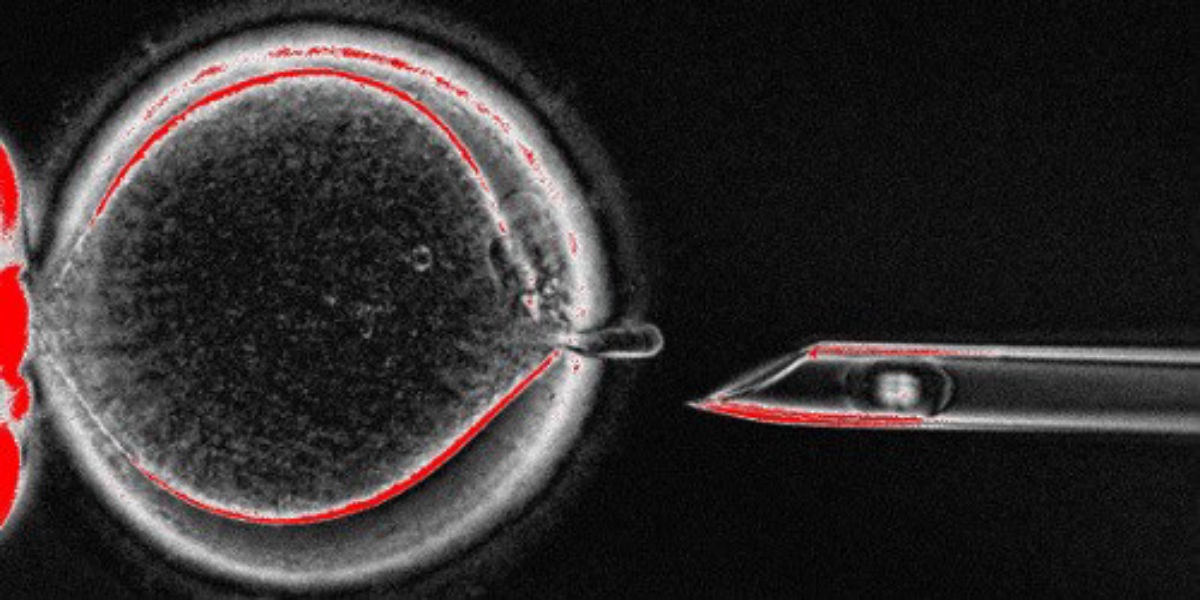 Con co 3 bo me nho can thiep gien: tuong lai hay tham hoa? anh 1