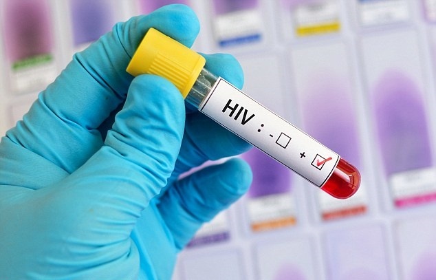 HIV đột biến đẩy nhanh quá trình phát triển thành AIDS ảnh 2 HIV dot bien day nhanh qua trinh phat trien thanh AIDS anh 2