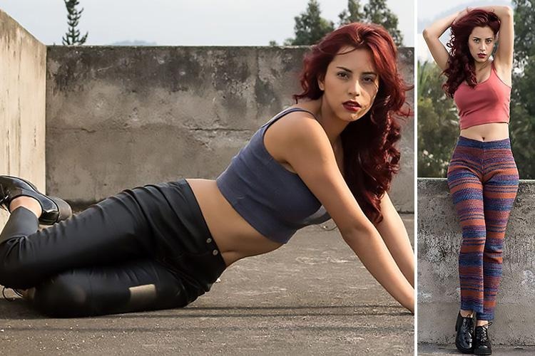 So phan bi tham cua co gai dau tien thuc hien hut mo trong lich su anh 3