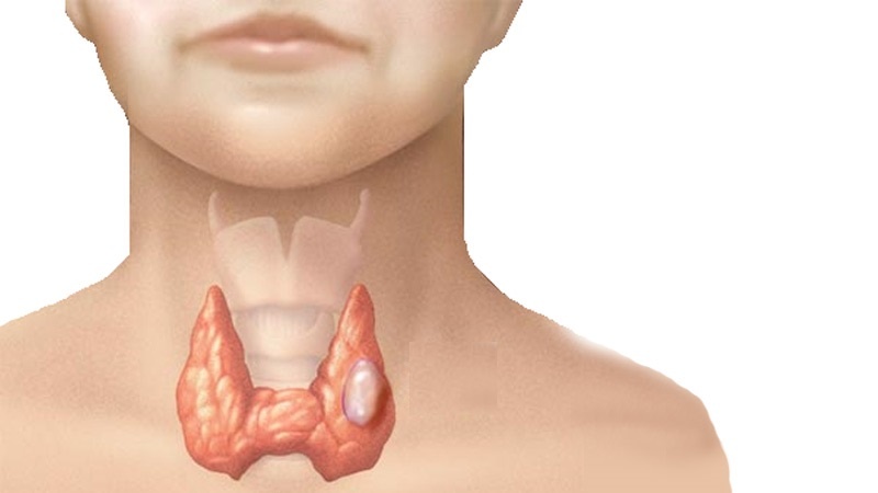 10 loai ung thu pho bien nhat o nguoi tre tuoi anh 10