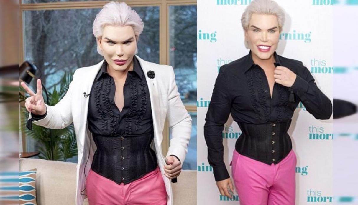 Su that ve phau thuat cat xuong suon de co vong eo con kien anh 3