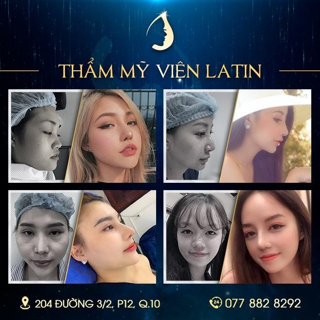 Vien tham my Latin anh 2