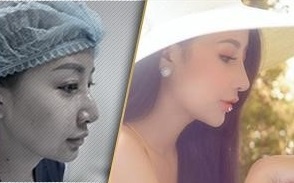 Suc hut tu nang mui cau truc Latin hinh anh