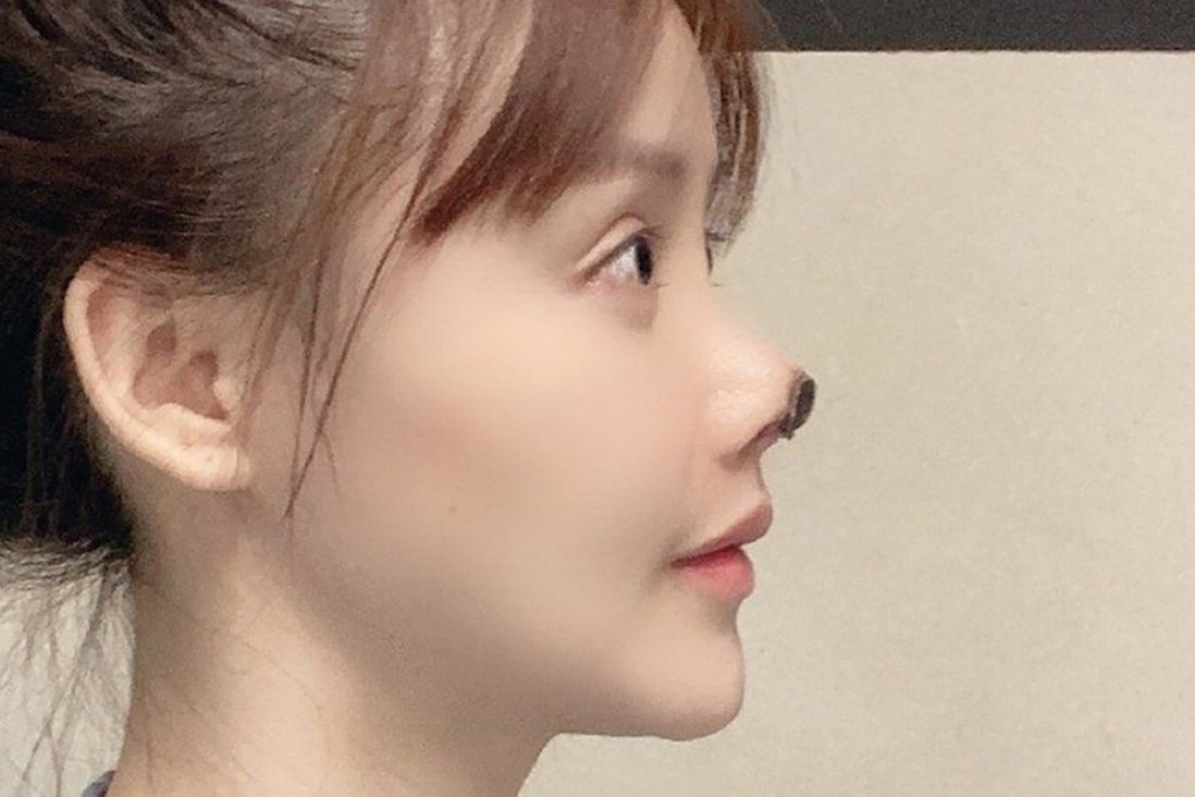 phau thuat tham my o Trung Quoc anh 4