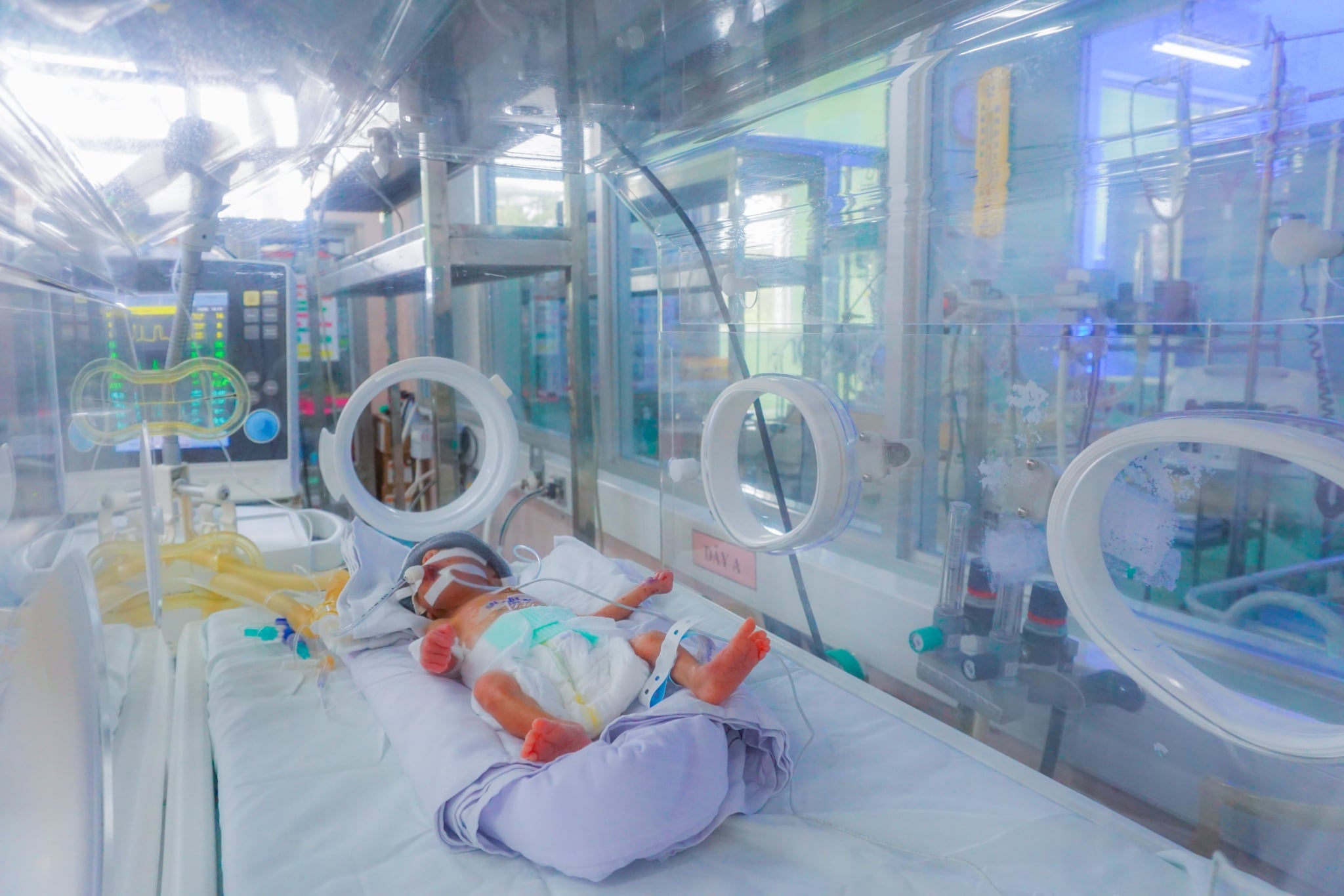 Tre so sinh la F1 anh 1