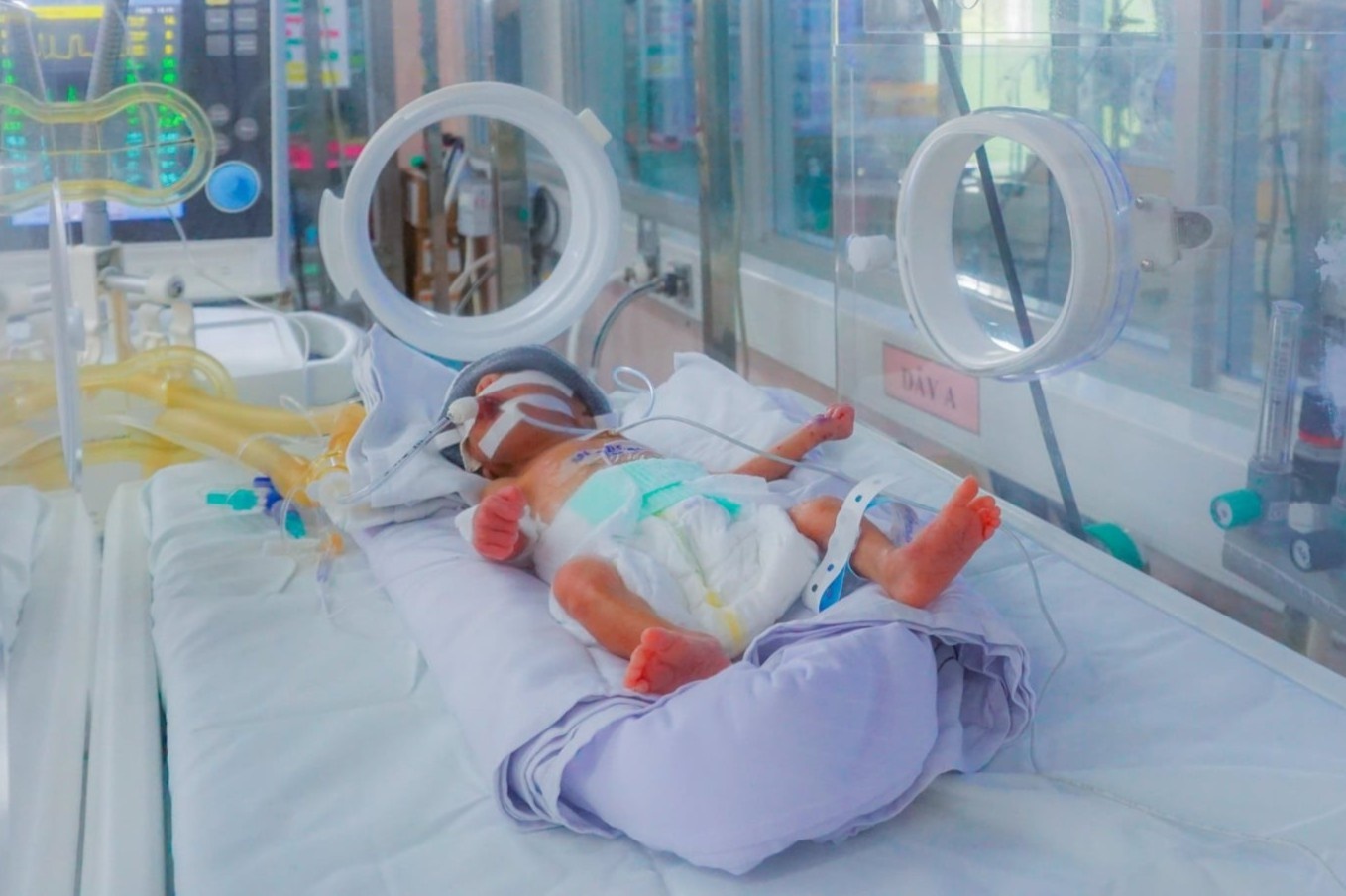 Nhieu san phu F0 va be so sinh F1 o TP.HCM can duoc giup do hinh anh