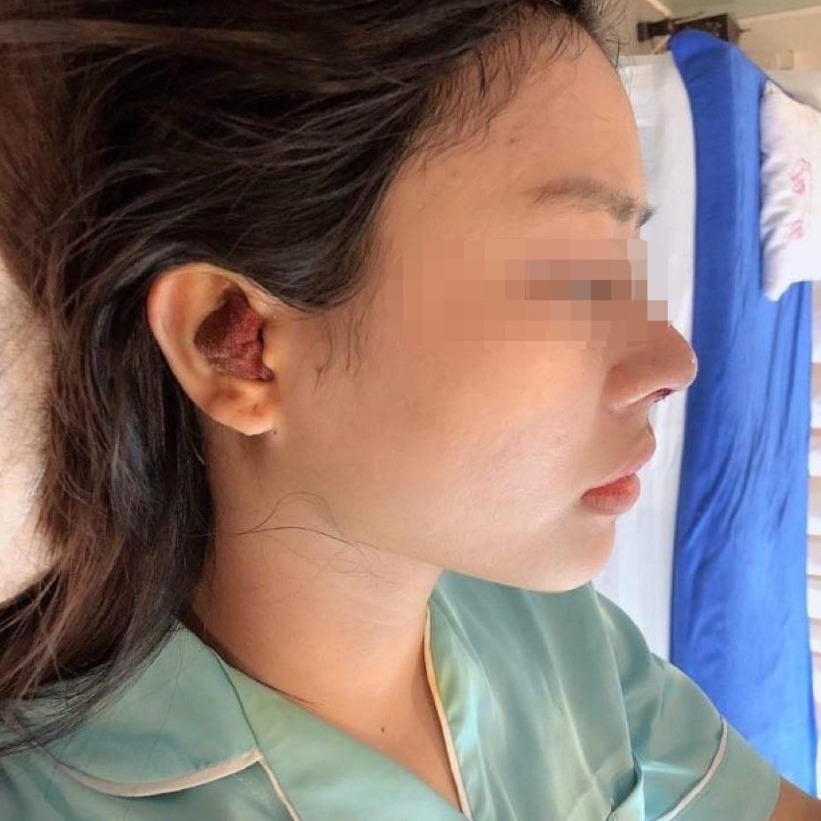 người trẻ phẫu thuật thẩm mỹ ảnh 1 nguoi tre phau thuat tham my anh 1