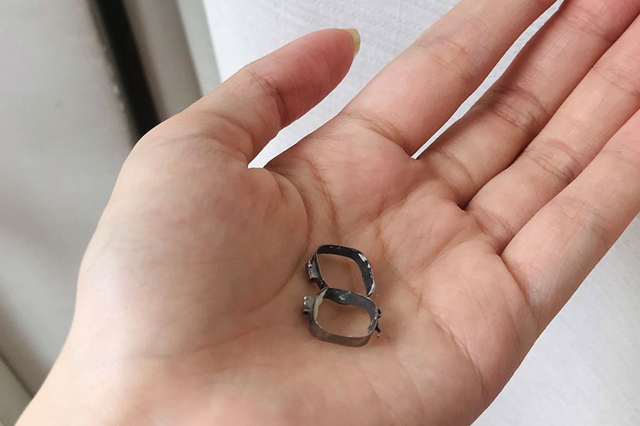 cần biết khi niềng răng ảnh 4 can biet khi nieng rang anh 4