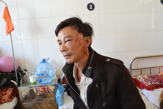 Con do chan xe, nem da tai xe roi cuop tai san hinh anh