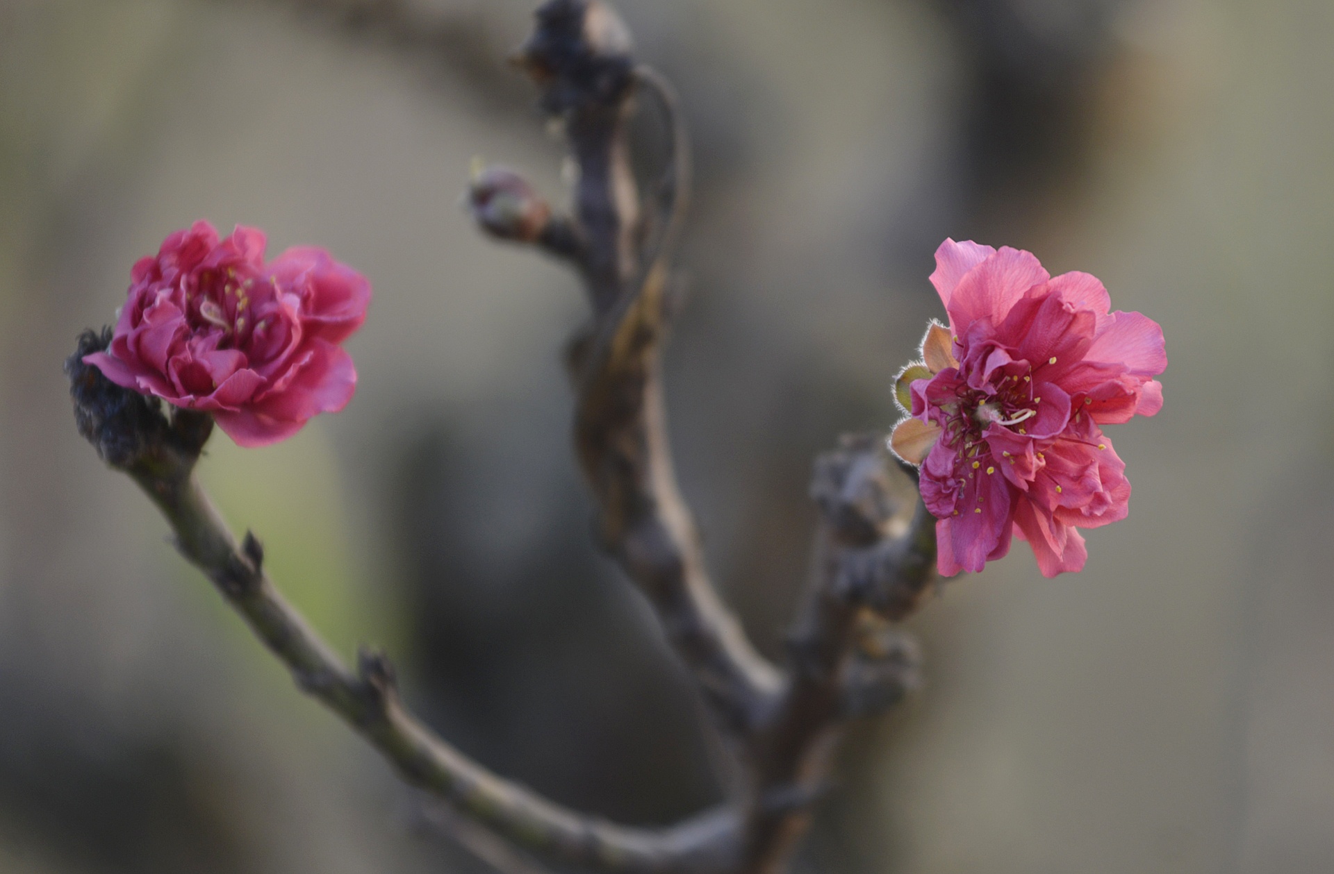 Dung dieu hoa u dao cho bung no anh 8