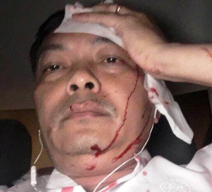 Giam doc nhan su Trung Nguyen bi danh: 'Toi khong mau thuan voi ai' hinh anh