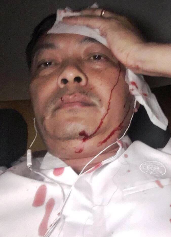 Giám đốc nhân sự cà phê Trung Nguyên bị tấn công ảnh 1 Giam doc nhan su ca phe Trung Nguyen bi tan cong anh 1