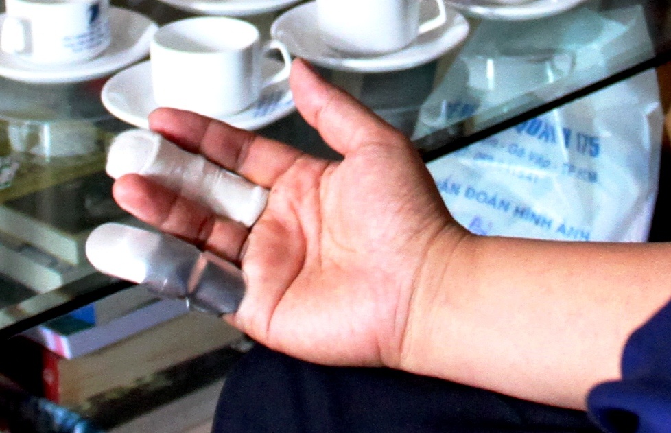 Giam doc nhan su Trung Nguyen bi danh anh 1