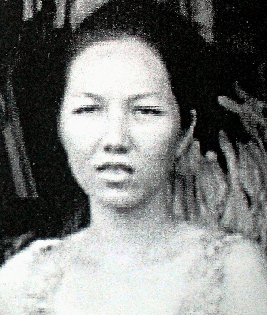 Phẫu thuật để trốn truy nã ảnh 2 Phau thuat de tron truy na anh 2