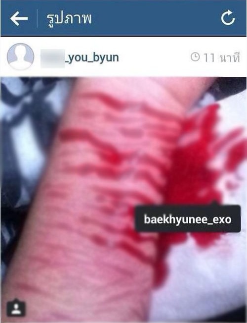 Mặc dù đa phần fan girl cảm thấy hụt hẫng khi một trong những giọng ca ngọt ngào của EXO đã “có chủ”, tin đồn về một cô gái tự rạch tay mình vì thất vọng không khỏi khiến tất cả choáng váng. Cô gái đăng lên mạng tấm ảnh tay be bét máu, và thậm chí tag cả tài khoản Instagram của Baekhyun. Cư dân mạng nửa tin nửa ngờ trước độ xác thực, vì không có thêm nguồn tin chính xác nào ngoài bức ảnh nói trên. Đây không phải lần đầu cộng đồng người hâm mộ EXO phải chứng kiến những bức hình rạch tay khủng khiếp từ một bộ phận fan cuồng. Ảnh: instagram