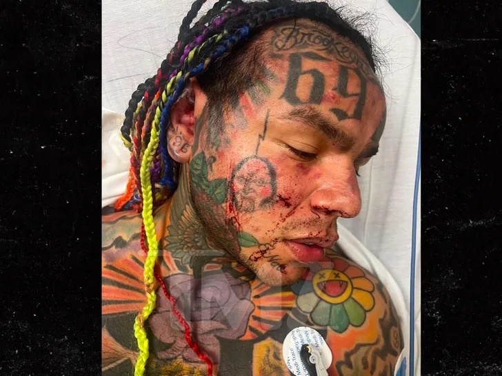6ix9ine anh 1