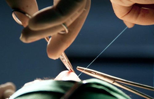 Tham my 5 lan, xem mat 200 lan de tim nguoi yeu dep trai hinh anh