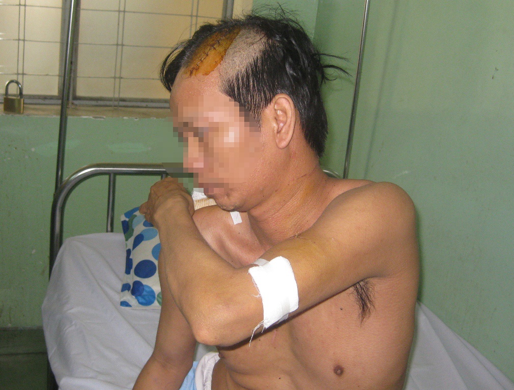 Vo co bi giang ho Sai Gon truy sat nguy kich giua duong hinh anh