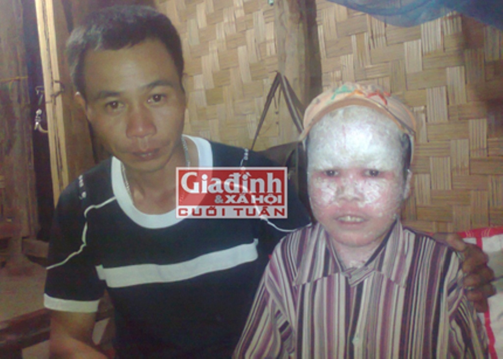 Mo uoc cua cau be nguoi ca suyt bi chon song hinh anh