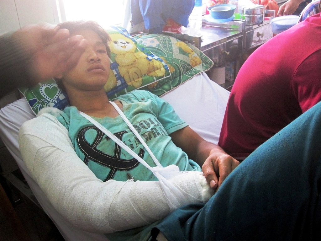 Nhom con do cat luoi nam thanh nien hinh anh