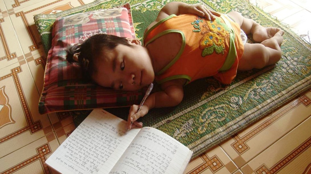 Co be 17 tuoi bai liet, cao 80cm co nghi luc phi thuong hinh anh
