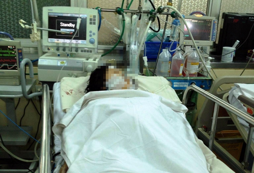 Chong chem vo dang mang bau, thai nhi roi ra ngoai hinh anh