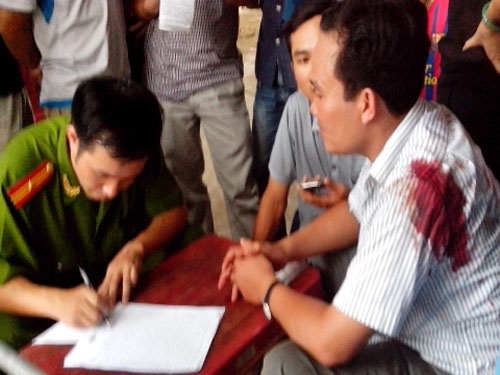 Bat khan cap ke dung sung de doa giet nguoi hinh anh
