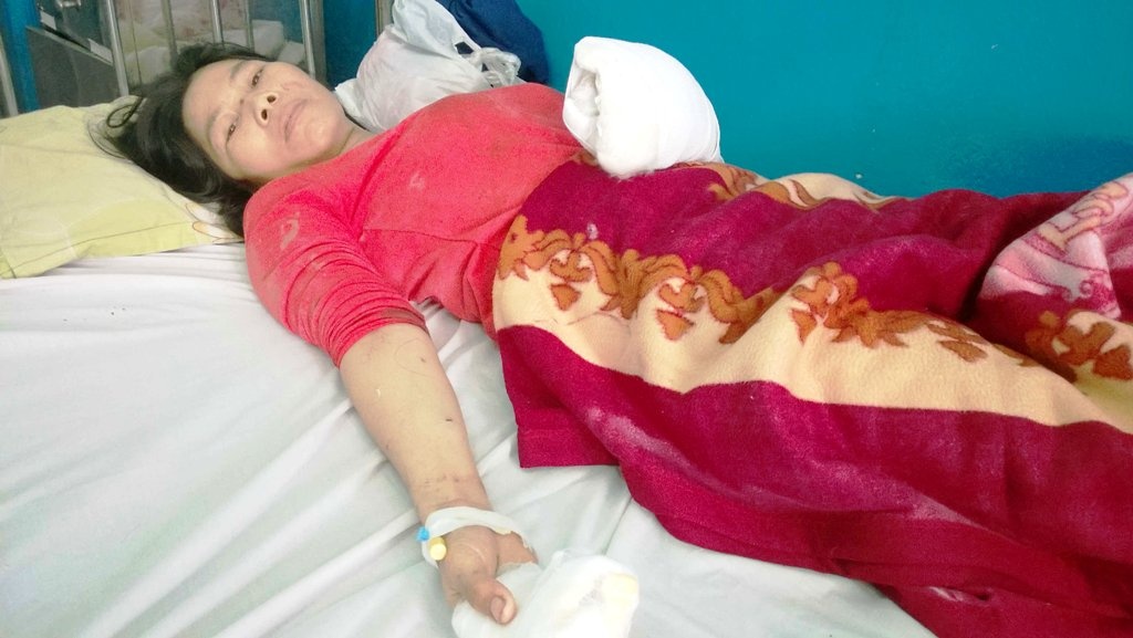 Xe om chem dut gan tay ba ban ve so hinh anh